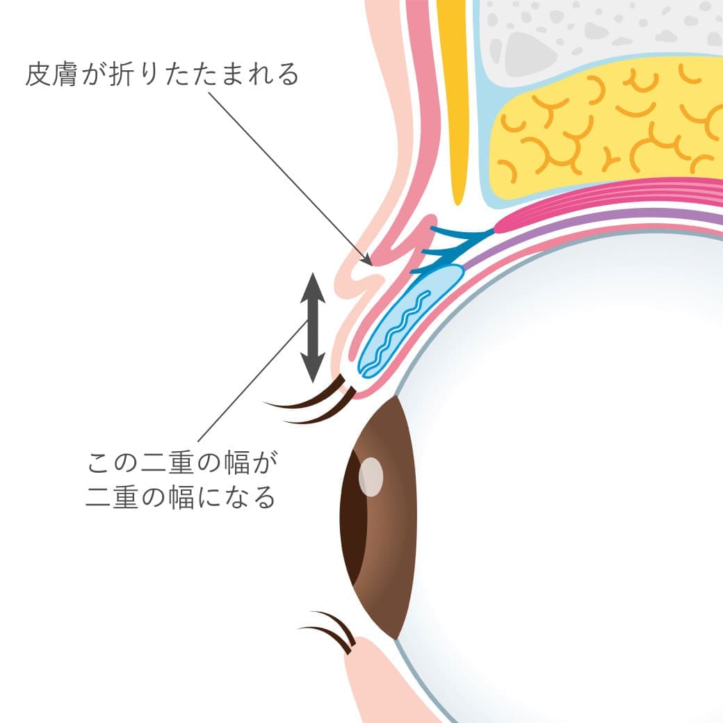 二重まぶたを横から見た図